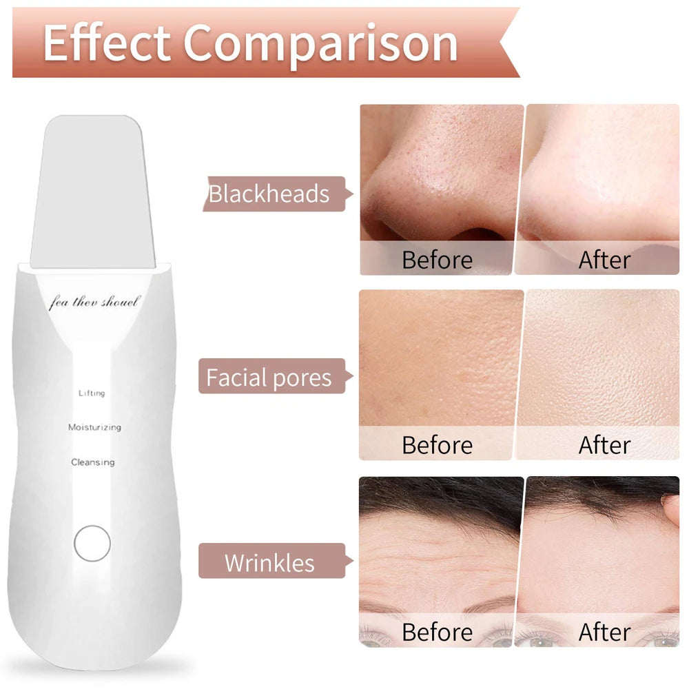 Exfoliante ultrasónico para la piel