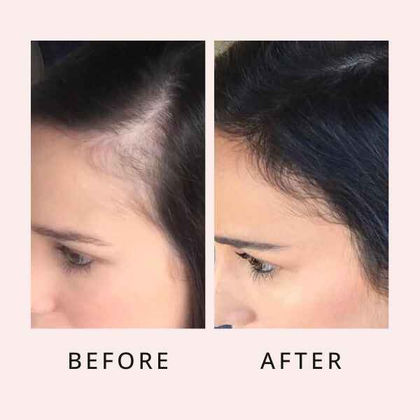 Hair Regrow Serum