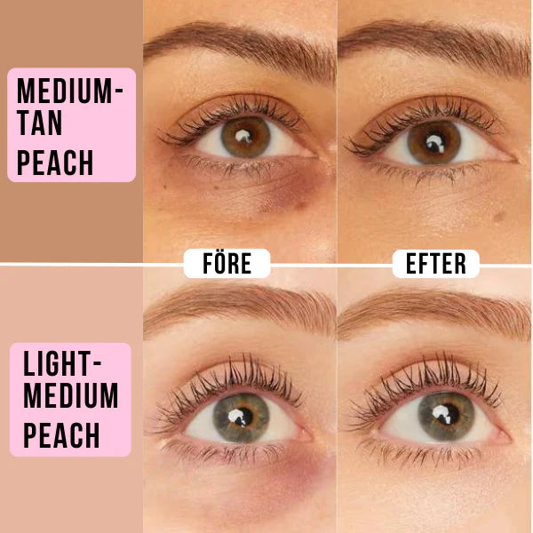 Zoe™ Under Eye Brightener