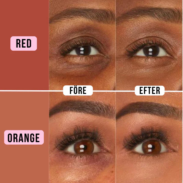 Zoe™ Under Eye Brightener