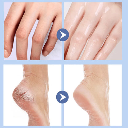 Urea Fotstift