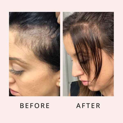 Hair Regrow Serum
