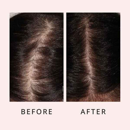 Hair Regrow Serum