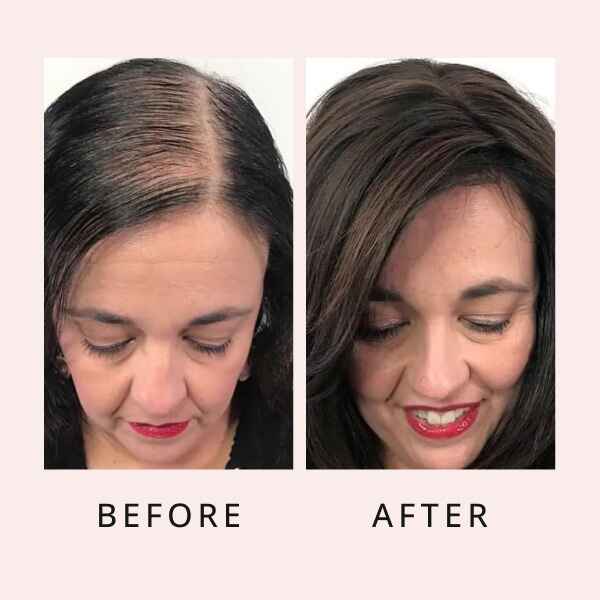Hair Regrow Serum