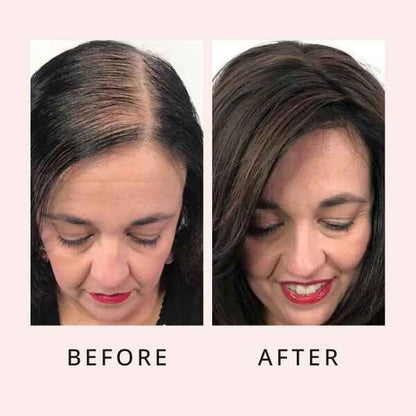 Hair Regrow Serum
